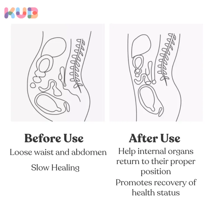 KUB%20Maternity%20Belt%20-%20Image%206