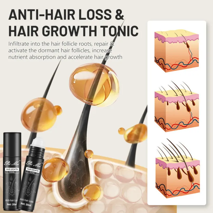 Peimei%20100%25%20Organic%20Ginger%20Hair%20Growth%20Tonic%20Oil%20Serum%20%E2%80%93%20Anti-Hair%20Loss%20&%20DHT%20Blocker%20-%20Image%203