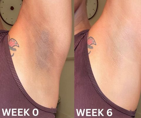 Aloe%20Vera%20Underarm%20Scrub%20Gel%20350ml%20%7C%20Soothing%20Exfoliating%20Gel%20for%20Dark%20Underarms%20%7C%20Natural%20Smell%20Remover%20&%20Skin%20Brightener%20%7C%20Underarms%20Roller%20Alternative%20%7C%20Sweat%20Control%20&%20Hair%20Removal%20Prep%20for%20Women%20&%20Men%20-%20Image%202