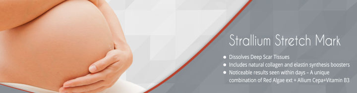 Strallium%20Stretch%20Mark%20Cream,%2075Gm%20-%20Image%203