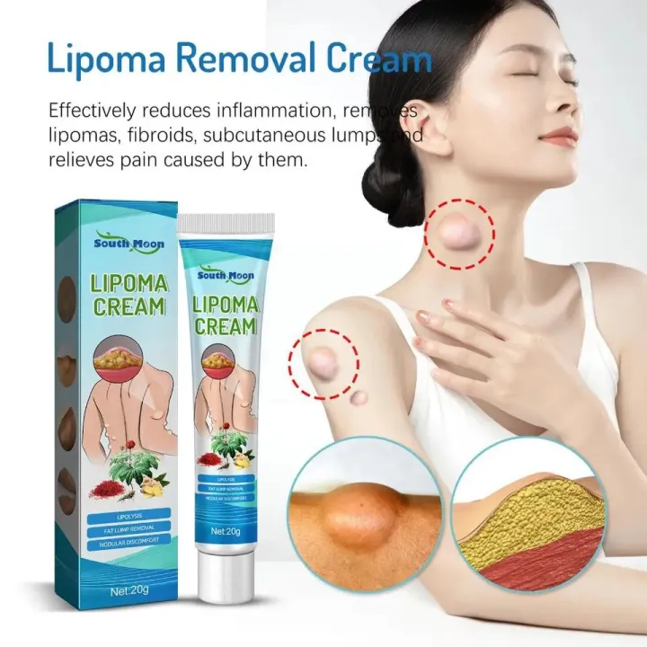 4pcs%20Lipoma%20Removal%20Cream%20%E2%80%93%20Herbal%20Natural%20Fat%20Lump%20Treatment%20%7C%20Sebaceous%20Cyst,%20Fibroma,%20Skin%20Lump,%20Fatty%20Tumor,%20Muscle%20Knot%20Removal%20Ointment%20%E2%80%93%2020g%20-%20Image%202