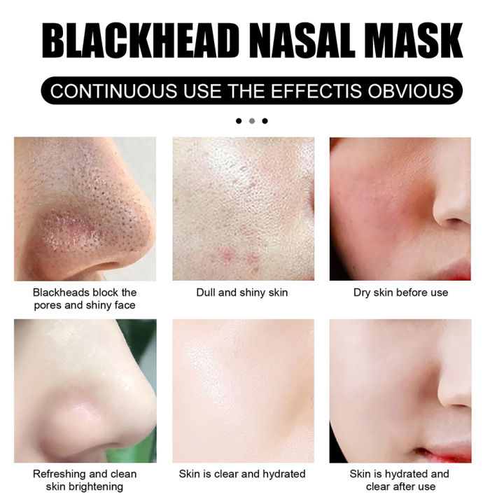 Blackhead%20Remover%20Cream%20Face%20Deep%20Cleansing%20Oil%20Control%20Black%20Head%20Remover%20Mask%20Nasal%20Deep%20Peeling%20Deaning%20Skin%20Care%20-%20Image%206