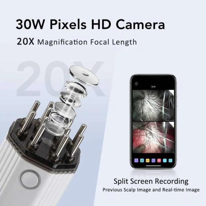 Hair%20Serum%20Applicator%20Comb%20Portable%20Electric%20Visual%20Scalp%20Vibration%20650nm%20Red%20Light%20for%20Follicle%20Stimulation%20Head%20Massage%20Relax%20-%20Image%202