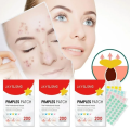 200 Patches Jaysuing Pimple Patches for Face, Hydrocolloid Acne Patches, Cute Star Zit Covers for Face. 