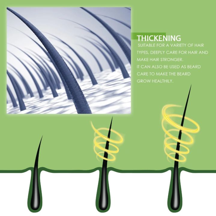 Thickening,%20Hair%20Protection,%20Baldness%20Remedy,%20Anti-Hair%20Loss,%20Rosemary%20Hair%20Growth%20Serum,%20Anti-Prevention,%20Growth%20Promotion,%20Scalp%20Treatment%20-%20Image%204