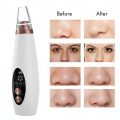 Original 6-in-1 Blackhead Remover Vacuum – Rechargeable Electric Pore Cleaner | Acne, Pimple, Black Spot Suction Device. 