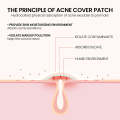 Pimple Patches for Face, Cute Star Zit Covers, Stars Hydrocolloid Acne Patch. 