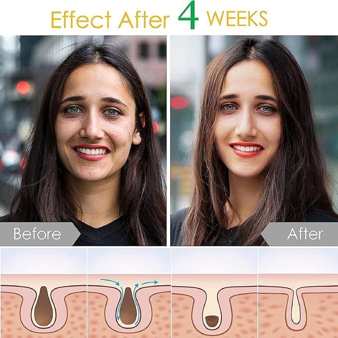 The%20Ordinary%20Supersize%20Hyaluronic%20Acid%202%25%20+%20B5%20Face%20Serum%20-30ml%20-%20Image%207