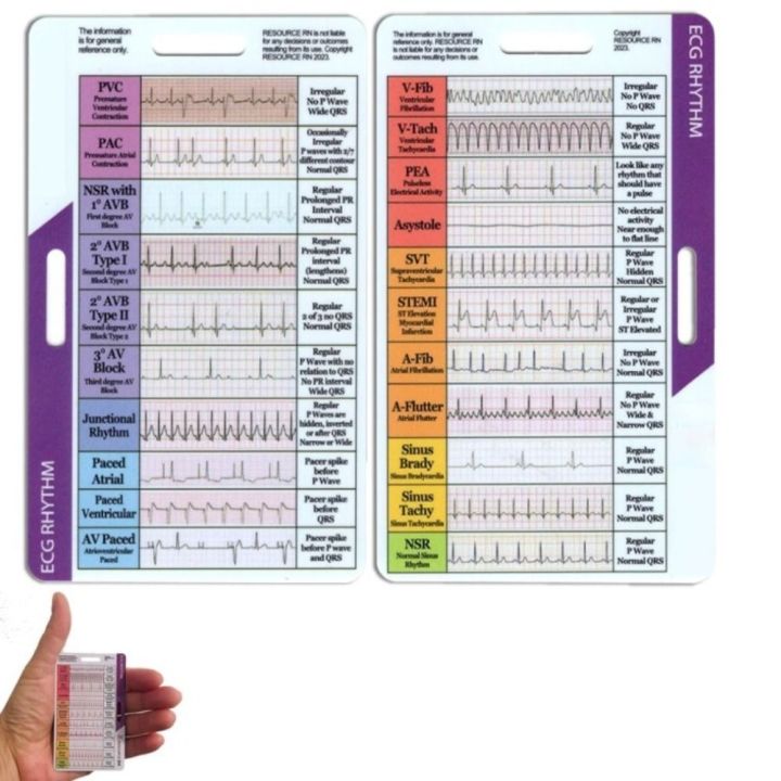 New DIY ECG/EKG Rhythm Pocket Card Personalized Interpretation Made ...