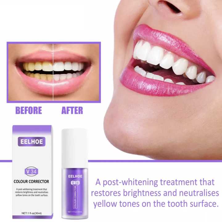EELHOE%20Colour%20Corrector%20Whitening%20Toothpaste%20-%20Eelhoe%20V34,%20Very%20Effective%20(30ml/1%20fl.oz.)%20-%20Image%206