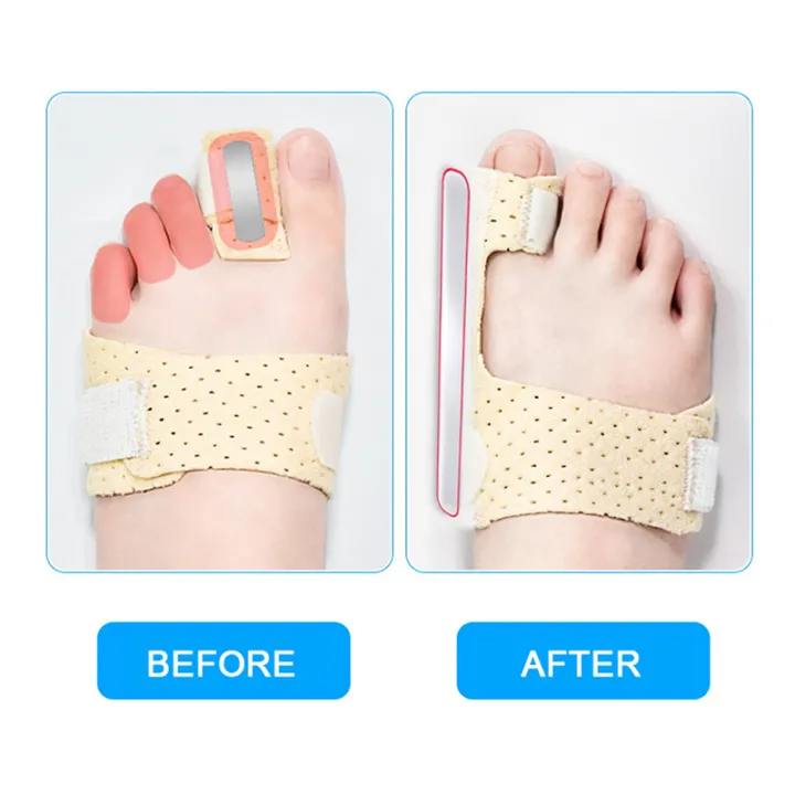 HOT%201PC%20Adjustable%20Hammer%20Toe%20Straightener%20Corrector%20For%20Metatarsalgia%20Claw%20Toe%20Mallet%20Toe%20Pain%20Relief%20Splint%20Foot%20Compression%20Wrap%20-%20Image%205