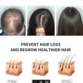 Disaar Rosemary Mint Scalp & Hair Strengthening Oil – Nourishing Hair Growth & Anti-Hair Fall Serum.. 