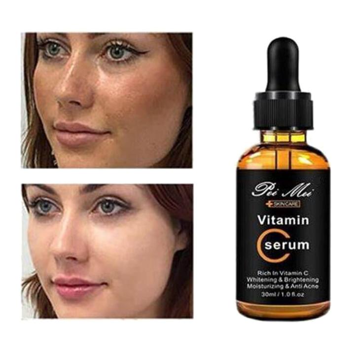 Updated 2025 Pei Mei Vitamin C Face Serum - 30ml
