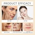 Botox Bee Venom Cream Anti Aging Wrinkle Remover Face Cream. 