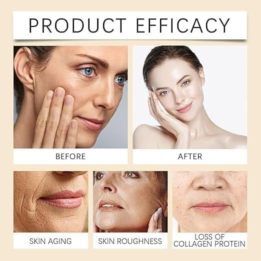 Botox%20Bee%20Venom%20Cream%20Anti%20Aging%20Wrinkle%20Remover%20Face%20Cream%20-%20Image%208