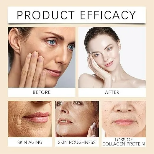 Botox%20Bee%20Venom%20Cream%20Anti%20Aging%20Wrinkle%20Remover%20Face%20Cream%20-%20Image%208