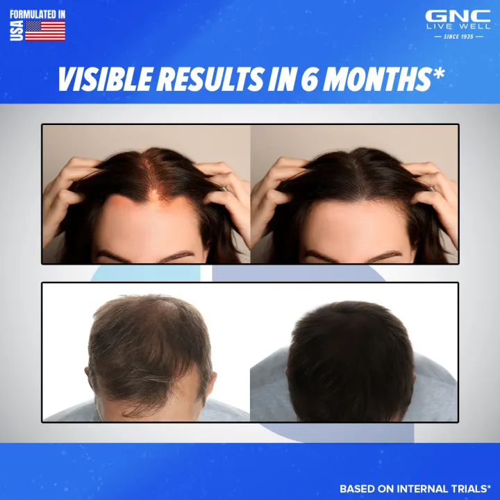 GNC%20Biotin%20Plus%2010,000mcg-%2030%20Tablets%20With%20Reduces%20Hair%20Fall%20&%20Promotes%20New%20Hair%20Growth%20-%20Image%206