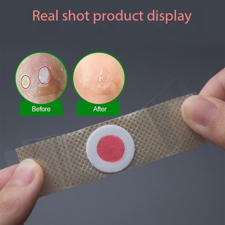 Pack%20Of%203%20Corn%20Remover%20Tape,%20Musa%20Kothi%20Hataune,%20Salicylic%20acid%20Tape%20-%20Image%202