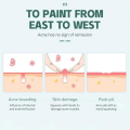 Acne Pimple Master Patch – Transparent Hydrocolloid Spot Treatment for Clear Skin | Korean Beauty Secret (36 Pcs). 