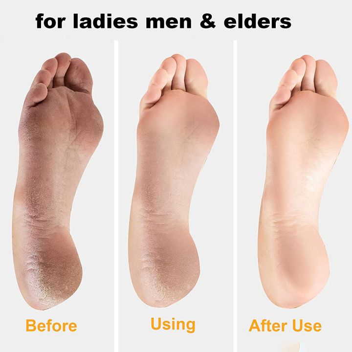 Pedicure%20Tools%20Heel%20Scratcher%20Files%20Artifact%20Exfoliating%20Calluses%20Brush%20Stainless%20Steel%20Foot%20Sharpening%20Double-sided%20Pedicura%20-%20Image%202