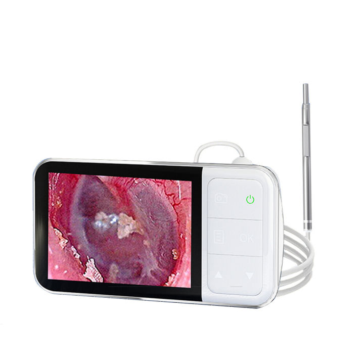 High definition endoscopic otology for ear cleaning