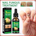 Jaysuing for Treating Gray Nails Nail Care Solution Ginger Essence. 