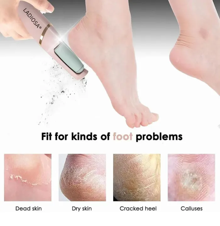 Flawless%20Electric%20Pedi%20Callus%20Remover%20-%20Image%203