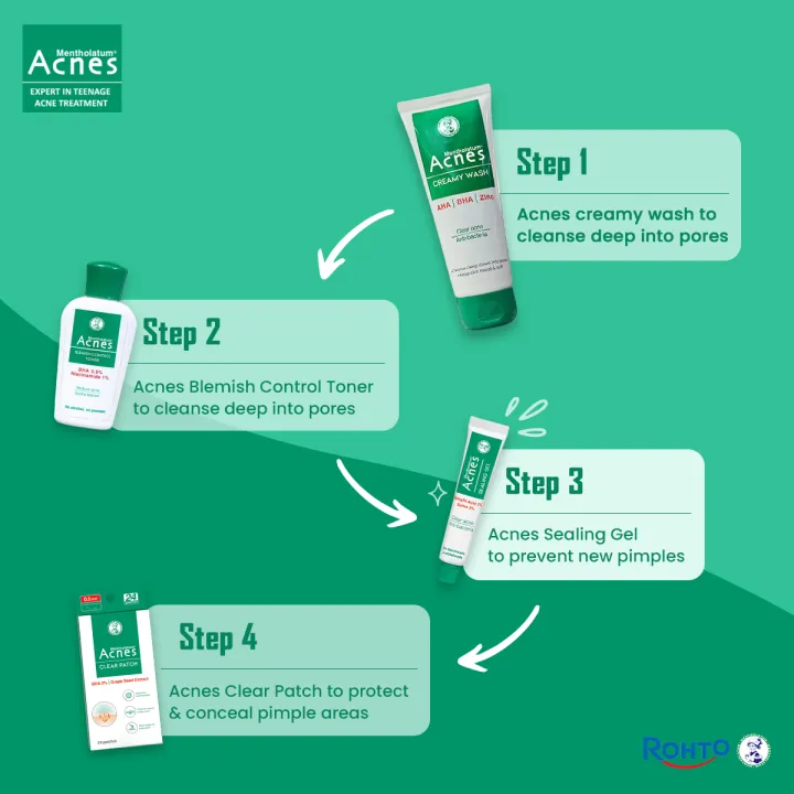 Rohto%20Mentholatum%20Pimple%20Care%20Pack%20(Acnes%20Creamy%20Wash%20100g%20+%20Acnes%20Soothing%20Toner%2090ml%20+%20Acnes%20Sealing%20Gel%2018g)%20-%20Image%208