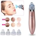Blackhead Remover Vacuum Tool Stick Machine Kit Pore Cleaner Acne & Blemishes. 