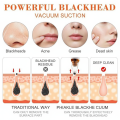 Original 6-in-1 Blackhead Remover Vacuum – Rechargeable Electric Pore Cleaner | Acne, Pimple, Black Spot Suction Device. 