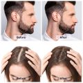0.5mm Derma Roller 540 Micro Needle Therapy Skin For Hair Treatment and Face. 