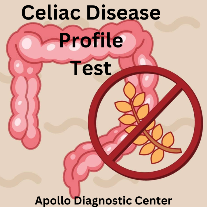 Celiac Disease Profile tTG (IgA, IgG) - Find out Gluten Intolerance ...