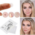36Pcs Skin Tag & Acne Patch Hydrocolloid Acne and Skin Tag Remover Patches. 