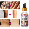 MOOYAM Kojic Underarms Brightening Serum - 30ml. 
