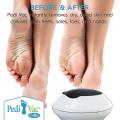 Rechargeable Electric Foot File PediVac – Callus Remover for Feet with Built-in Vacuum Removes Dead Skin from Feet. 