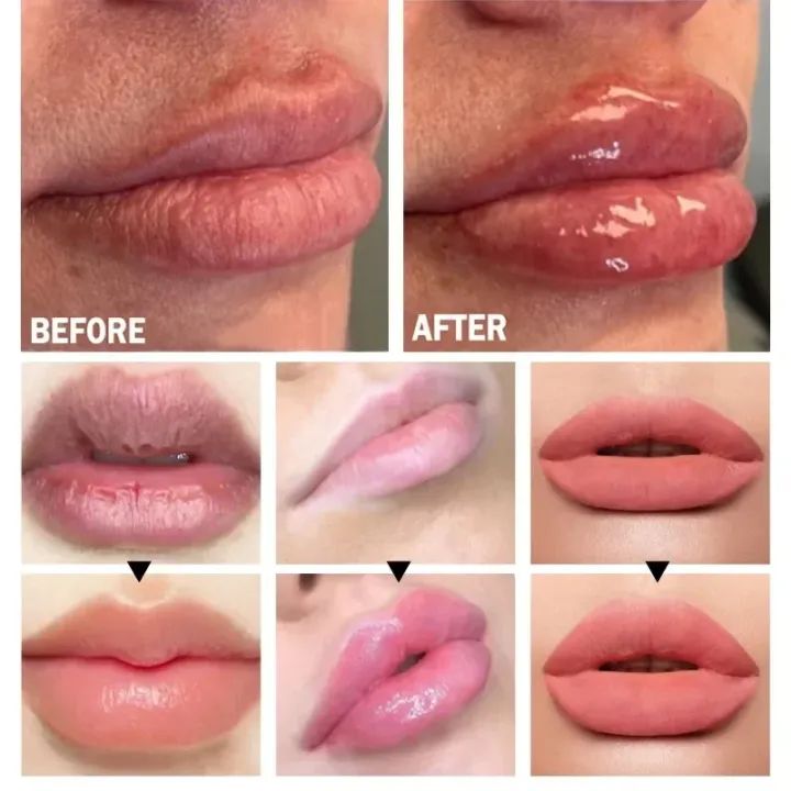 99%20Mall%20Offer%201-Piece%20Portable%20Lip%20Plumper%20%E2%80%93%20Ginger%20&%20Mint%20Infused%20Lip%20Care%20Serum%20for%20Fuller,%20Softer,%20and%20Hydrated%20Lips%20By%2099%20Stores%20-%20Image%204
