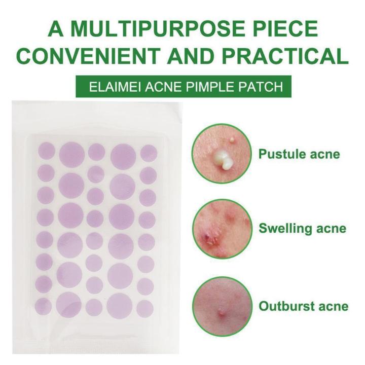 HOT%201Sheet%20Pimple%20Acne%20Concealer%20Face%20Spot%20Scar%20Care%20Sticker%20Patch%20Acne%20Removal%20Cute%20Tool%20Pimple%20Heart%20Acne%20Beauty%20Flower%20Invis%20S2H4%20-%20Image%203
