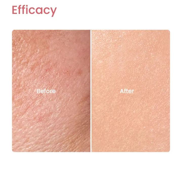 Earth%20Rhythm%20Kombucha%20Body%20Yogurt%20for%20Deeply%20Nourished,%20Moisturised%20and%20Glowing%20Skin%20%7C%20Light%20Weight%20Hydration%20%7C%20All%20Skin%20Types%20%7C%20Men%20&%20Women%20-%20100ml%20-%20Image%202