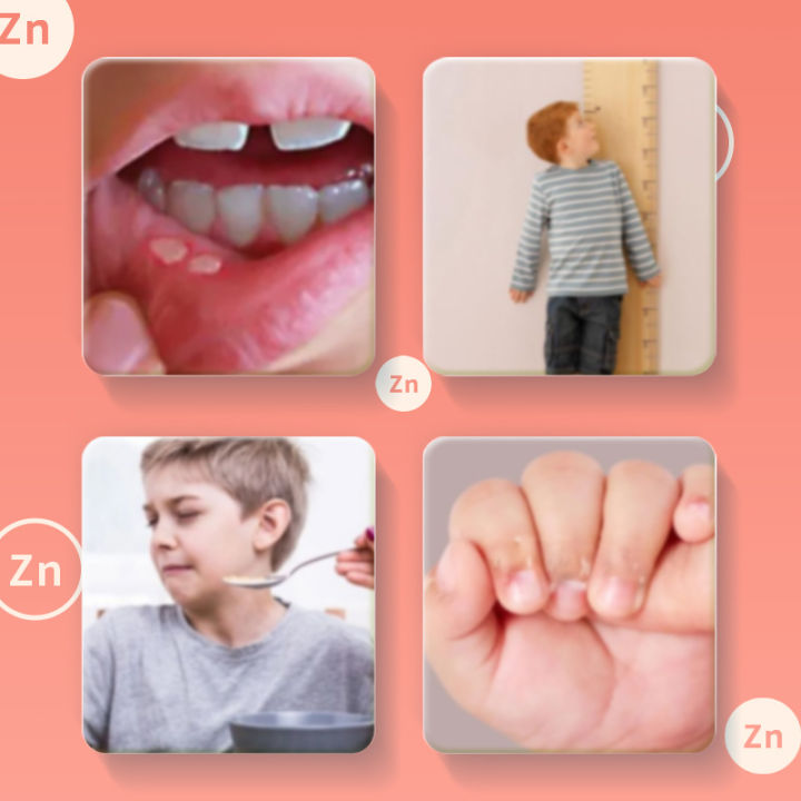 Zinc%20gluconate%20oral%20liquid,%20North%20China%20Pharmaceutical%20Zinc%20Supplementation%20Oral%20Liquid,%20wholesale%20calcium,%20iron,%20zinc%20oral%20liquid%20-%20Image%202