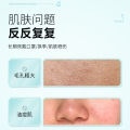 Azelaic Acid Gel Gel Acne Cream Removes AcneGently Brightens Skin Pore Shrinking Serum Improves Large Pores and Blackheads. 