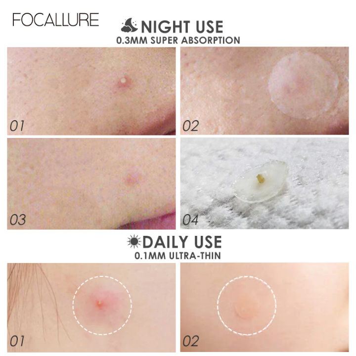 Focallure%20-%20Focallure-FA186%20ACNE%20Pimple%20Daily%20Patch%20-%20Image%207