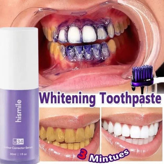 HISMILE V34 Purple Orthopedic Toothpaste , Deep Stain Remover , Instant Teeth Whitening serum , Natural Teeth Whitening, Teeth Polish , Teeth Stain Remover , Alternative to Toothpaste , Tooth serum for Sensitive Teeth & Freshens Breath