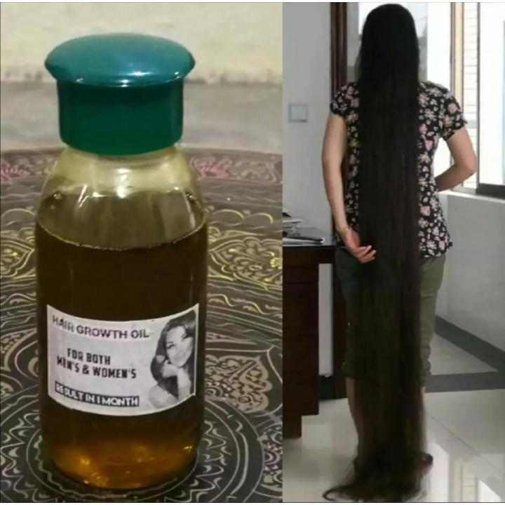 Onion oil for hair growth, Onion Seeds Oil (600ml), 100% Pure Natural Hair Oil, Cold pressed Oil, Onion oil with Black seeds, Onion Hair Oil, Onion oil with Black seeds oil, Anti Dandruff