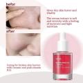 Anua Niacinamide 10% + TXA 4% Dark Spot Correcting Serum. 