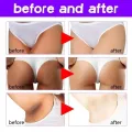 Face Body Brightening Cream Thigh Underarm Inner Melanin Lightening Lotion Feminine Gentle Nourishing Dark Skin Care Cream New. 