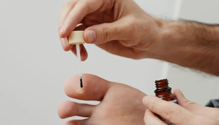 Duofilm%20Solution%2015ml%20%7C%20Wart%20&%20Corn%20Remover%20%7C%20Salicylic%20Acid%20Treatment%20for%20Skin%20-%20Image%204