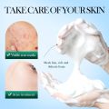 Sadoer Tea Tree Mousse Facial Cleanser Remove Blackhead Bubble Sponge Refreshing Cleanser & Face Wash 150g. 