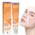 Trimoskin Clobevate Orange Cream (◕‿◕) for Face, Scar Removal, Acne, Hand, Foot, and Pigmentation With Kojic Acid Non Steroidal For All Skin Types - Girl & Women. 