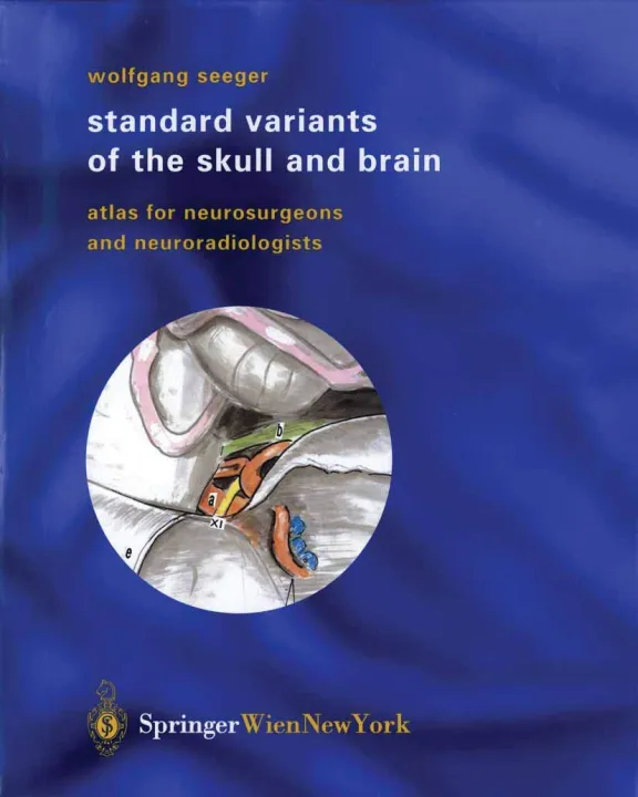 Standard Variants of the Skull and Brain Atlas for Neurosurgeons and ...