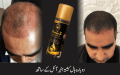 Premium Original Kushta Hair Oil 120ml Kushta Hair Oil & Marham (Booster) is designed to address hair loss, thinning, and fall. - Original Hakeem Musa Hair Growth-Hair Oil/hairoil-hair oil -Hair Care&gt;Oil & Serums- Kushta Hair Oil & Marham (Booster). 